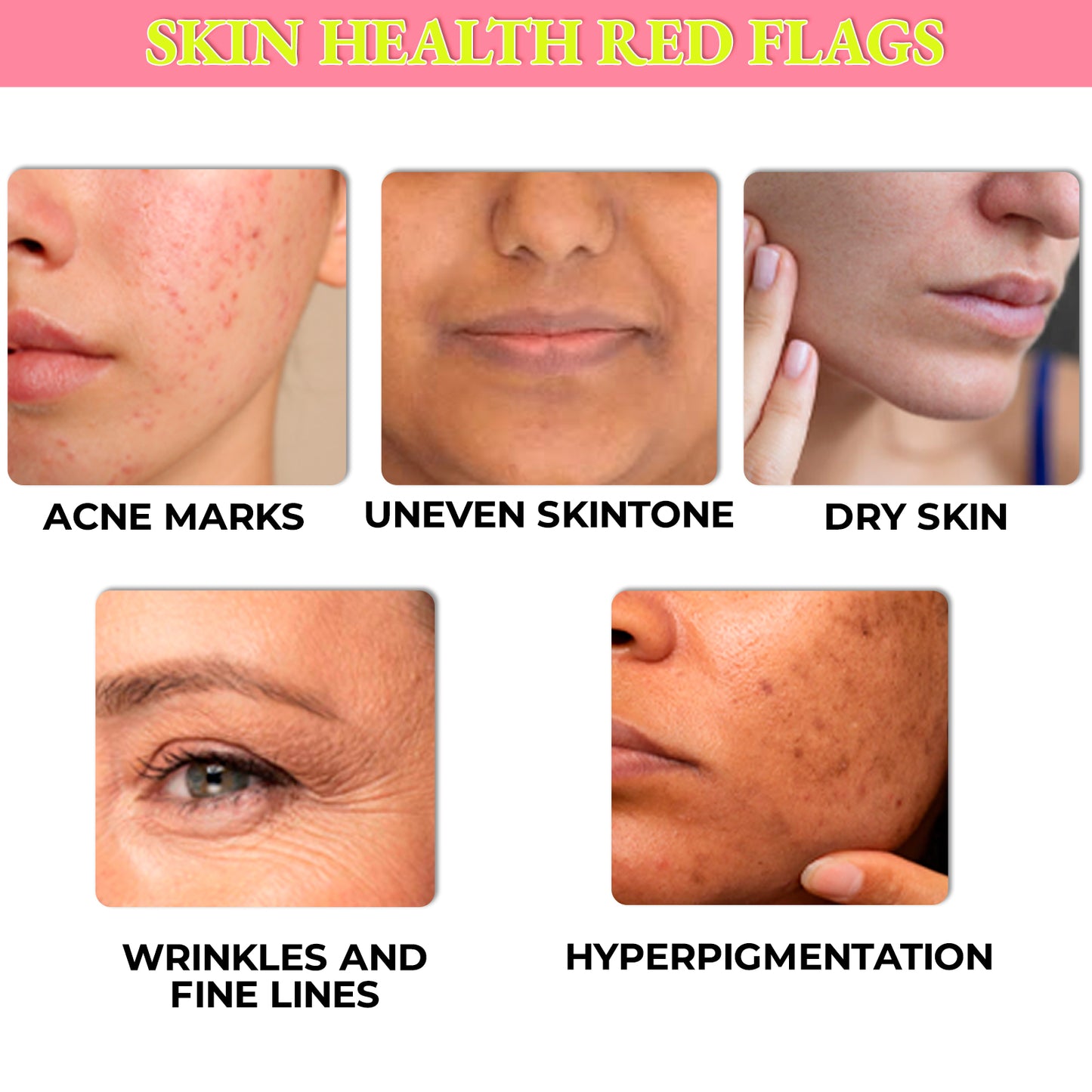 Skin 101